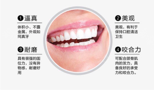 韓國登騰Dentium種植體