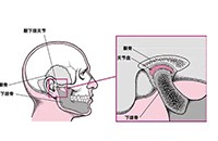 顳下頜關(guān)節(jié)疾病