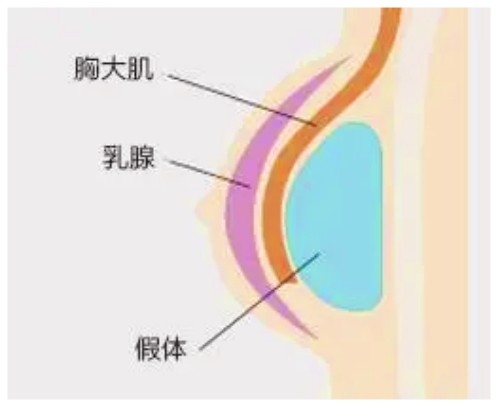 米蘭柏羽開(kāi)啟胸部醫(yī)生面診日，穆大力、李英大親診做出精致自然美胸