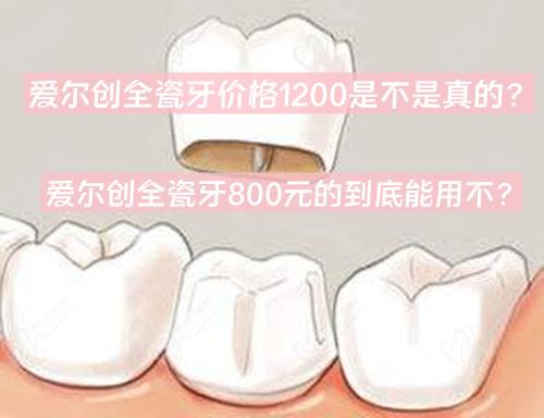 愛爾創(chuàng)全瓷牙價(jià)格1200是不是真的