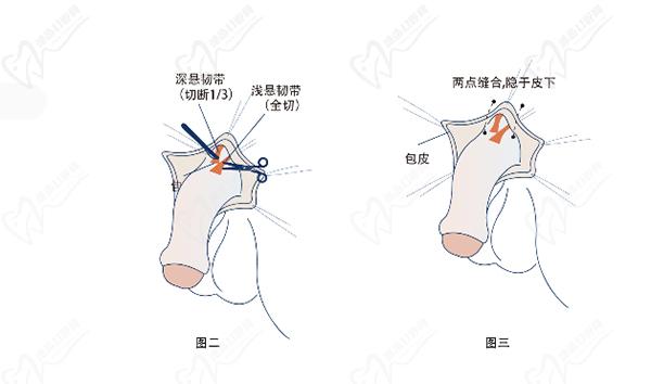 重慶星榮整形醫(yī)院李世榮預(yù)約掛號時間