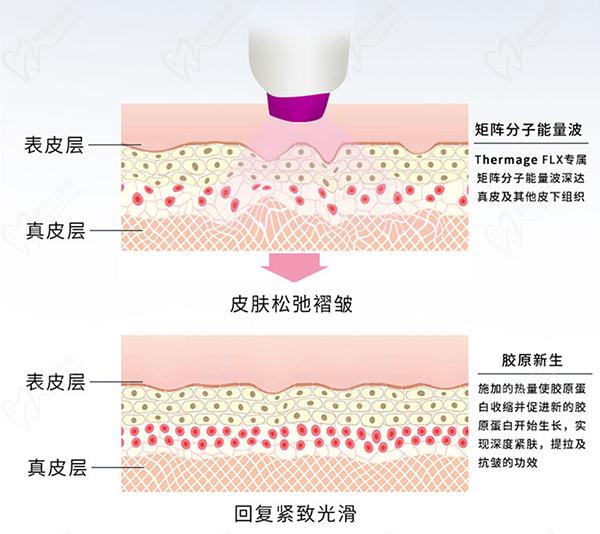 熱瑪吉