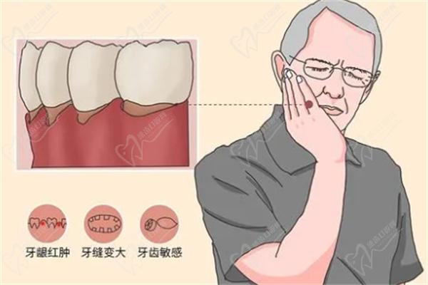 牙齦萎縮有幾期癥狀