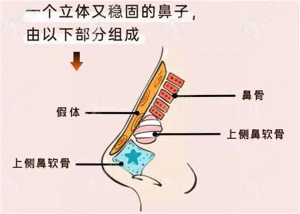 鼻整形