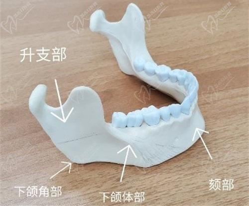 李獻(xiàn)和醫(yī)生磨骨改臉型價(jià)格