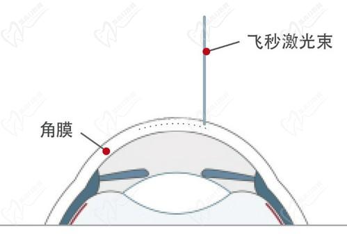 王曉瑛醫(yī)生在哪里出診？上海普瑞、上海和平等眼科醫(yī)院可預(yù)約